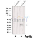 Western blot analysis of extracts from Mouse liver tissue, using IDI1 Antibody. The lane on the left was treated with blocking peptide.