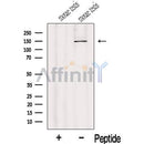 Western blot analysis of extracts from Mouse testis tissue, using IFT122 Antibody. The lane on the left was treated with blocking peptide.