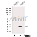 Western blot analysis of extracts from Human brain tissue, using IFT27 Antibody. The lane on the left was treated with blocking peptide.