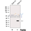 Western blot analysis of extracts from Human testis tissue, using IFT43 Antibody. The lane on the left was treated with blocking peptide.