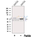 Western blot analysis of extracts from Mouse brain tissue, using IGSF21 Antibody. The lane on the left was treated with blocking peptide.