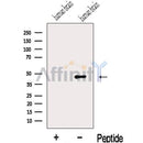 Western blot analysis of extracts from Human brain tissue, using IIP45 Antibody. The lane on the left was treated with blocking peptide.