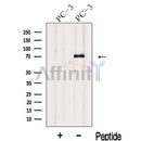 Western blot analysis of extracts from PC-3 cells, using IL17RE Antibody. The lane on the left was treated with blocking peptide.