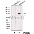 Western blot analysis of extracts from Human skeletal muscle  tissue, using IL1RAPL1 Antibody. The lane on the left was treated with blocking peptide.