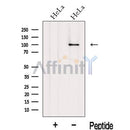 Western blot analysis of extracts from HeLa cells, using Importinbeta Antibody. The lane on the left was treated with blocking peptide.