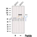 Western blot analysis of extracts from HeLa cells, using INPP5B Antibody. The lane on the left was treated with blocking peptide.