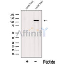 Western blot analysis of extracts from Mouse brain tissue, using INTS3 Antibody. The lane on the left was treated with blocking peptide.