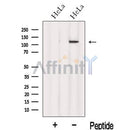 Western blot analysis of extracts from HeLa cells, using INTS8 Antibody. The lane on the left was treated with blocking peptide.
