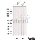 Western blot analysis of extracts from Jurkat cells, using INTS9 Antibody. The lane on the left was treated with blocking peptide.