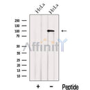Western blot analysis of extracts from HeLa cells, using IPO13 Antibody. The lane on the left was treated with blocking peptide.