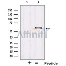 Western blot analysis of extracts from Jurkat cells, using IRF2BP2 Antibody. The lane on the left was treated with blocking peptide.