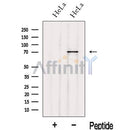 Western blot analysis of extracts from HeLa cells, using IVNS1ABP Antibody. The lane on the left was treated with blocking peptide.