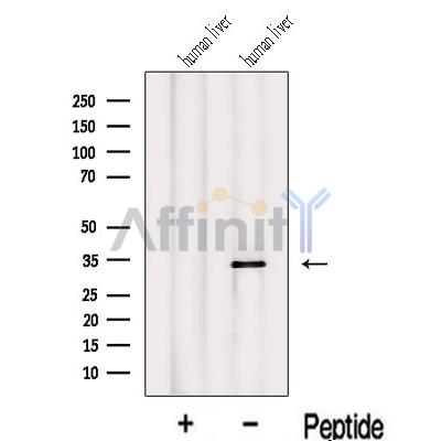 Western blot analysis of extracts from Human liver tissue, using IYD Antibody. The lane on the left was treated with blocking peptide.