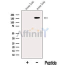 Western blot analysis of extracts from Mouse brain tissue?, using JMJD3 Antibody. The lane on the left was treated with blocking peptide.