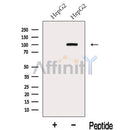 Western blot analysis of extracts from HepG2 cells, using KANK2 Antibody. The lane on the left was treated with blocking peptide.