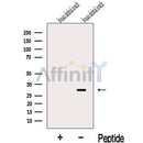 Western blot analysis of extracts from Human skeletal muscle  tissue, using KCNE4 Antibody. The lane on the left was treated with blocking peptide.