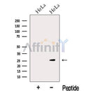 Western blot analysis of extracts from HeLa cells, using KCTD5 Antibody. The lane on the left was treated with blocking peptide.