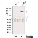 Western blot analysis of extracts from Jurkat cells, using KDM2A Antibody. The lane on the left was treated with blocking peptide.