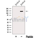 Western blot analysis of extracts from Jurkat cells, using KIAA0182 Antibody. The lane on the left was treated with blocking peptide.