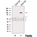 Western blot analysis of extracts from Human brain tissue, using KIF19 Antibody. The lane on the left was treated with blocking peptide.