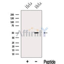 Western blot analysis of extracts from HeLa cells, using KLF10 Antibody. The lane on the left was treated with blocking peptide.