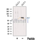 Western blot analysis of extracts from HeLa cells, using KLHL18 Antibody. The lane on the left was treated with blocking peptide.