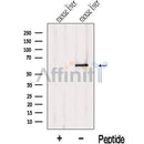 Western blot analysis of extracts from Mouse liver tissue?, using KRBP Antibody. The lane on the left was treated with blocking peptide.