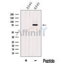 Western blot analysis of extracts from A549 cells, using Kv1.3 Antibody. The lane on the left was treated with blocking peptide.