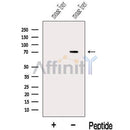 Western blot analysis of extracts from Mouse liver tissue?, using Kv1.4-Specific Antibody. The lane on the left was treated with blocking peptide.