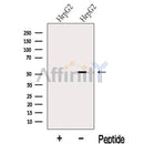 Western blot analysis of extracts from HepG2 cells, using LACTB Antibody. The lane on the left was treated with blocking peptide.