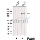 Western blot analysis of extracts from MCF7 cells, using LARS2 Antibody. The lane on the left was treated with blocking peptide.