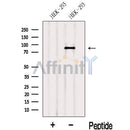 Western blot analysis of extracts from HEK-293 cells, using LAS1L Antibody. The lane on the left was treated with blocking peptide.