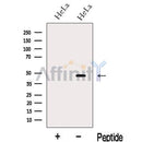 Western blot analysis of extracts from HeLa cells, using LASS2 Antibody. The lane on the left was treated with blocking peptide.