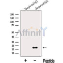 Western blot analysis of extracts from Chloroquine treated HepG2  cells, using LC3C-Specific Antibody. The lane on the left was treated with blocking peptide.