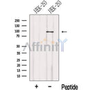 Western blot analysis of extracts from HEK-293 cells, using LENG8 Antibody. The lane on the left was treated with blocking peptide.