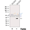 Western blot analysis of extracts from Human placenta tissue, using LETM2 Antibody. The lane on the left was treated with blocking peptide.