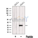 Western blot analysis of extracts from HeLa cells, using LIN7C Antibody. The lane on the left was treated with blocking peptide.
