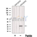 Western blot analysis of extracts from Mouse pancreas tissue, using LOH12CR1 Antibody. The lane on the left was treated with blocking peptide.