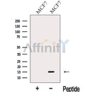 Western blot analysis of extracts from MCF7 cells, using LSM4 Antibody. The lane on the left was treated with blocking peptide.