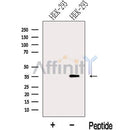 Western blot analysis of extracts from HEK-293 cells?, using LZTFL1 Antibody. The lane on the left was treated with blocking peptide.