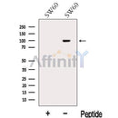 Western blot analysis of extracts from SW60 cells, using MACC1 Antibody. The lane on the left was treated with blocking peptide.