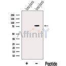 Western blot analysis of extracts from Human placenta tissue, using MAN1A2 Antibody. The lane on the left was treated with blocking peptide.