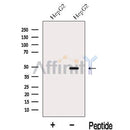 Western blot analysis of extracts from HepG2 cells, using MAT2A Antibody. The lane on the left was treated with blocking peptide.