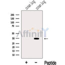 Western blot analysis of extracts from Mouse lung tissue, using MDH2 Antibody. The lane on the left was treated with blocking peptide.