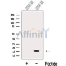 Western blot analysis of extracts from COLO 320 cells, using MED10 Antibody. The lane on the left was treated with blocking peptide.
