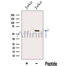 Western blot analysis of extracts from ?Jurkat cells, using MEIS2 Antibody. The lane on the left was treated with blocking peptide.