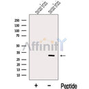 Western blot analysis of extracts from Mouse brain tissue, using METTL1 Antibody. The lane on the left was treated with blocking peptide.