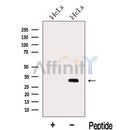 Western blot analysis of extracts from HeLa cells, using METTL6 Antibody. The lane on the left was treated with blocking peptide.
