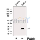 Western blot analysis of extracts from Jurkat cells, using MFAP5 Antibody. The lane on the left was treated with blocking peptide.