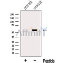 Western blot analysis of extracts from Mouse testis  tissue, using MGAT4C Antibody. The lane on the left was treated with blocking peptide.